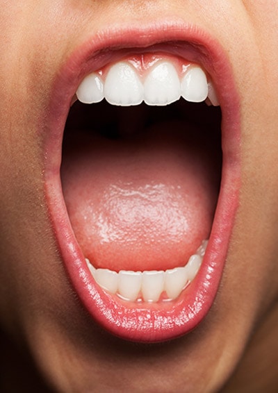 תסמונת הפה השורף