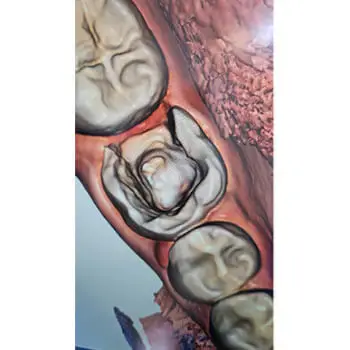 הדמיית סורק המאפשרת לבצע מילואה